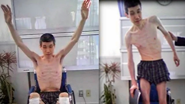 In hospital shortly after his release in February 2008, weighing just 39 kg (86 lb). Photo: Kazuhiro Yonemoto / National Association of Victims of Abduction, Confinement, and Forced Deconversion.